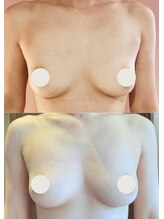 プレジール/バストボリュームアップ