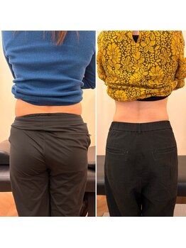 ナオ接骨院(NAO接骨院)/Before/After、痩身/ダイエット