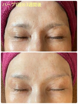 コティーバイホイヤ(Cotty by HOIYA)/◎ハーブトリートメント