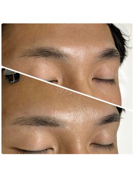 ゴリラアイブロウ 旭川店/ワックス脱毛で角質も除去！