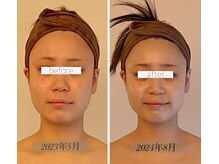 パル コルギサロン(Pal. Korugi salon)/コルギビフォーアフター