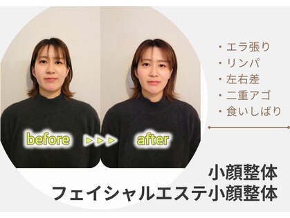 トマリギ(Tomarigi)の写真
