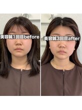 ハリサロンドオフ 堺東店(hari salon de off)/お客様before→after