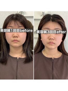 ハリサロンドオフ 堺東店(hari salon de off)/お客様before→after