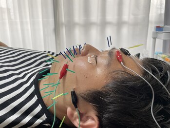 ハリトト鍼灸院/メンズ美容鍼灸