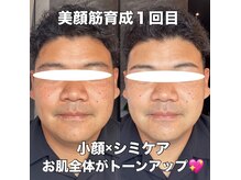 リエル(RIEL)の雰囲気（【美顔器育成写真】たるみ、色ムラ、シワ、赤み、肌質改善＆予防）