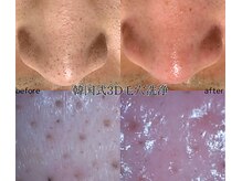 パイシーズ(Pisces)