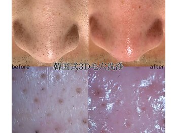 パイシーズ(Pisces)