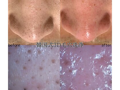 パイシーズ(Pisces)の写真