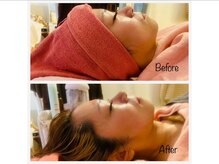 スターリィ スカイ(Starry☆Sky)/【小顔矯正】