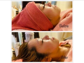 スターリィ スカイ(Starry☆Sky)/【小顔矯正】