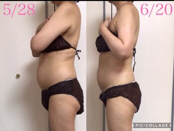 サロン ジョリー(Salon Jolie)/お腹ヤせ1ヶ月でこの変化！