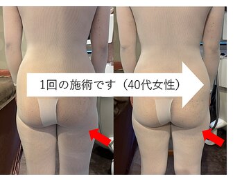 ココラ/ビフォーアフター