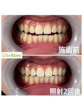 ルブラン 奈良店(Le Blanc)/男性のお客様！