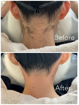 ビオトーン バイ ツリー(biotone by TREE)の写真/痛みが少ないの口コミ多数!★4.98の高評価サロンで、脱毛デビューしませんか?