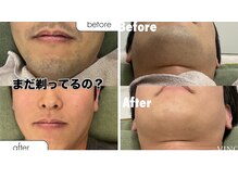 メンズビノス 福井店(VINOS)の雰囲気（LINEからもご予約可能です♪）