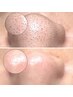 PR用|毛穴|毛穴洗浄|毛穴ケア|黒ずみ毛穴|毛穴悩み|開き毛穴|角栓
