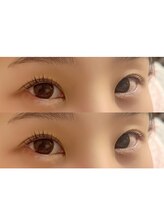 ルー(Lou)/ラッシュリフト