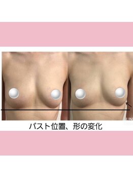 ミリミリ(mili mili)/バスト変化！