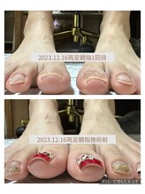 ブロックファイブハナ(Block 5 HANA)/