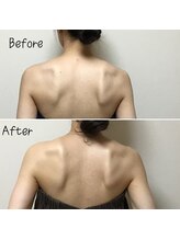 アルディート(Ardito)/肩甲骨はがし