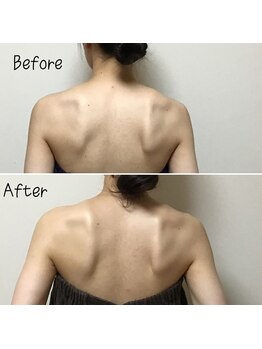 アルディート(Ardito)/肩甲骨はがし