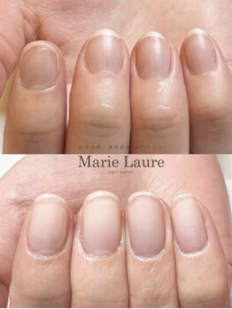 マリーロール 天王寺店(Marie Laure)/自爪育成/深爪矯正/ネイルケア