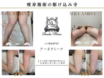 アーネラミーナ(Anela mina)の写真