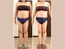 リライブ 亀有店(Re:Lives)/全身ビフォーアフター【痩身】