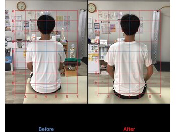 ストレチックス 近江八幡店/before/after