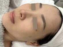 ウェクシー 名古屋駅前店(WECXII)/色むらのないノーファンデ肌に