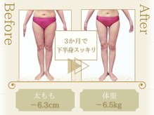 ピュアエステ ブリアント 松戸店/お客様の結果［松戸/痩身］