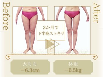 ピュアエステ ブリアント 松戸店/お客様の結果［松戸/痩身］