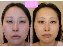 楓整骨院/10～20代にもおすすめ♪