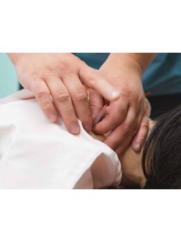 鍼灸施術を受けたい