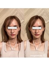 エクボ 立川店(EKUBO)/