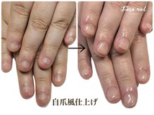ティアラネイル 宇都宮/リプロネイル深爪矯正コース