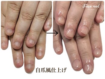 ティアラネイル 宇都宮/リプロネイル深爪矯正コース