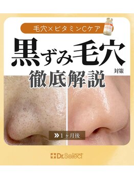 ハピネス 心斎橋アメリカ村本店(Happiness)/疲れやすい、毛穴くすみ気になる