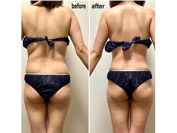 ラ マジ(La Magie)/