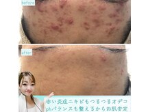 ビューティリュクス(beauty luxe)