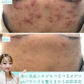 ビューティリュクス(beauty luxe)