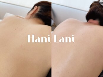 ハニ ラニ(Hani Lani)の写真/マンツーマン施術!はじめての脱毛は信頼・丁寧・通いやすさで。やさしさ重視のデビュー応援サロン♪