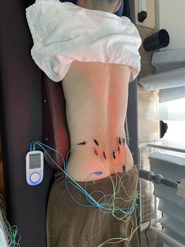 キヅキ鍼灸整体スタジオ(KIZUKI鍼灸整体スタジオ)/腰の施術