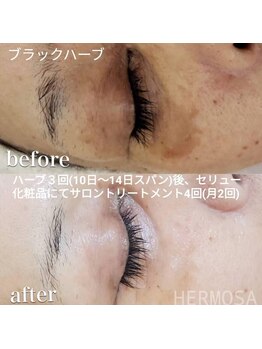 ベオ(Salon Beo)/ハーブにもランクがあります