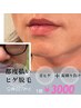 【メンズヒゲ脱毛】都度払いで青ヒゲ ヒゲソリ跡卒業30分 ¥4500→¥3,000