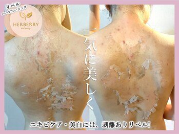ハーバリー ハーブピーリング 金山店(HERBERRYハーブピーリング)/名古屋ハーブピーリングHERBERRY