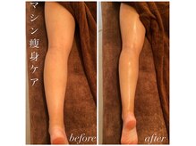 クオコア(KUOKOA)/Before/After