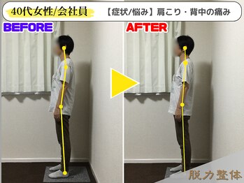 幸せのもり整体院/【40代女性/会社員】Nさん
