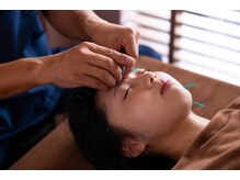 ココロ(CoCoLo)/美容鍼灸